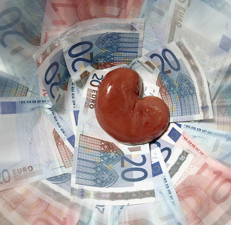 Бүйрегін 18 мың долларға сатпақ болған