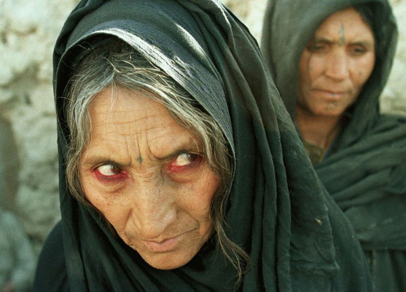 Көз тиюдің ғылыми және діни негіздері