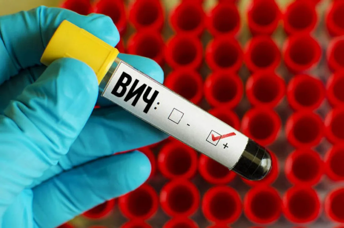 Атырау облысында 21 ЛГБТ мүшелері ВИЧ жұқтырып алды