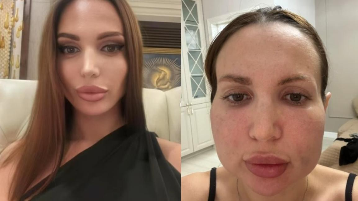 Астаналық әйелге косметолог ерлердің жыныс мүшесін өсіретін дәрі салған