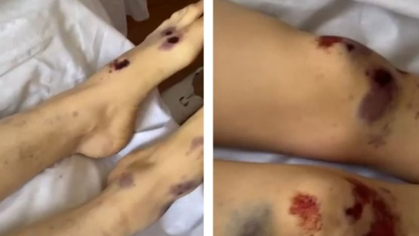 "Қолың сыңғыр, қалай өлтірдің?": күйеуі атқа сүйреп өлтірген Айзаттың азапты өлімі