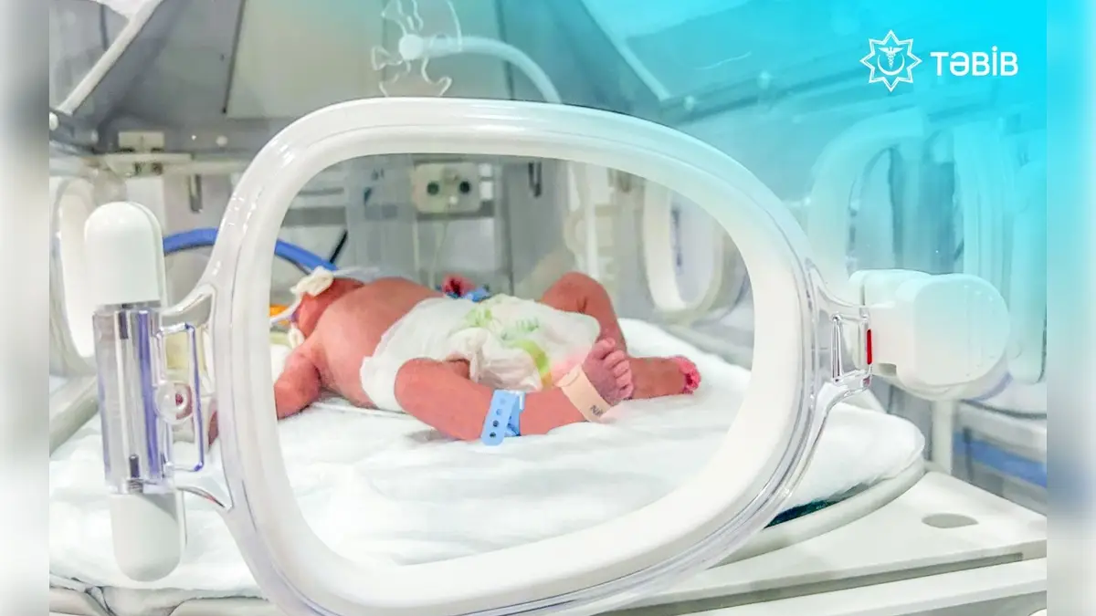 Бакуде жас әйел метро станциясында босанып қалды