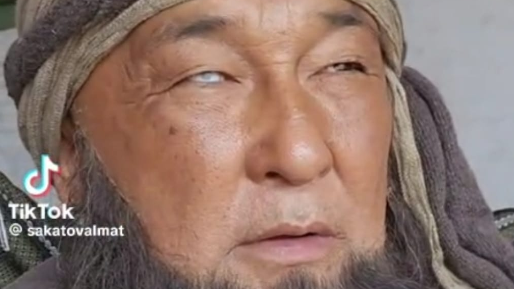 "Виаграны" жарнамалап, көзден айырылыпты" дескен жұрт актердің түрінен шошыды