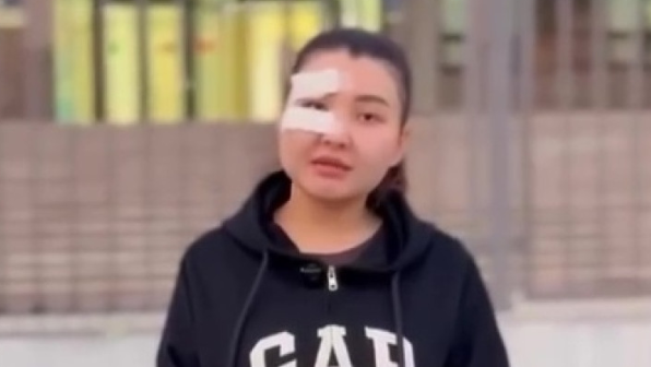 "Ұятсыз видеолар": Блогерді қансырата тепкілеп тастаған