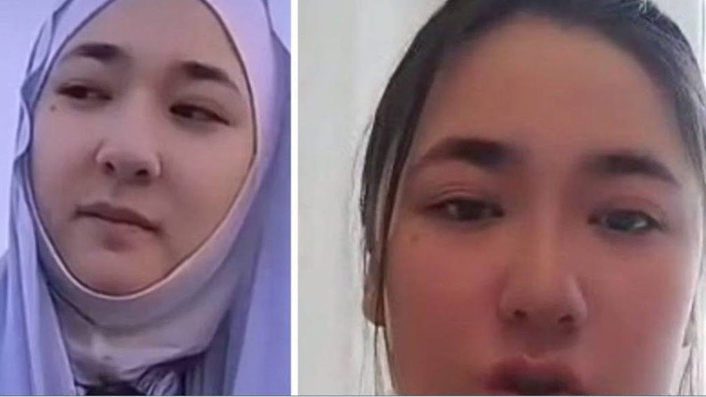 Шашты кискаларды жалау