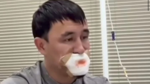 Сүйісіп, тілінен айырылған жігіт туралы тың ақпарат шықты