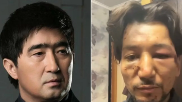 Мұқасан Шахзадаев ән үшін Ғалымжанның "бетін тегістеп" жіберген