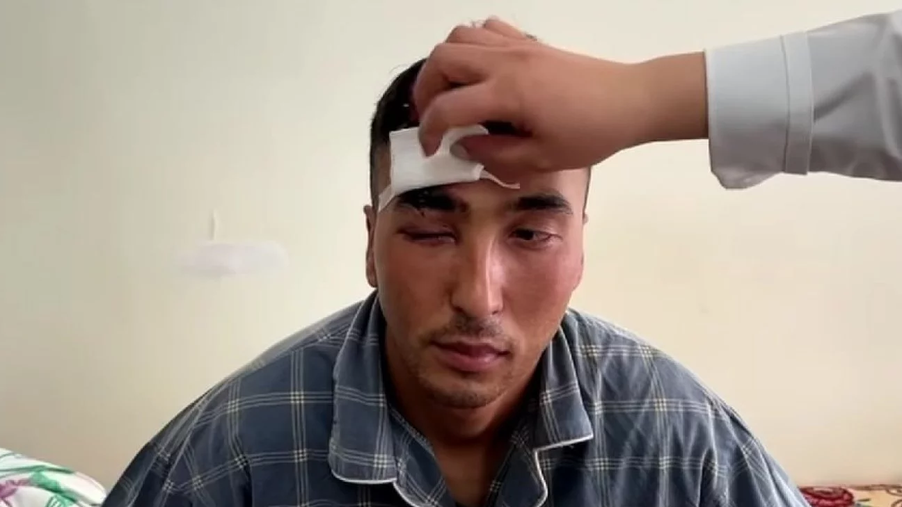 Сарбаз ант қабылдау кезінде өз басын бөтелкемен ұрып, жарақат алды