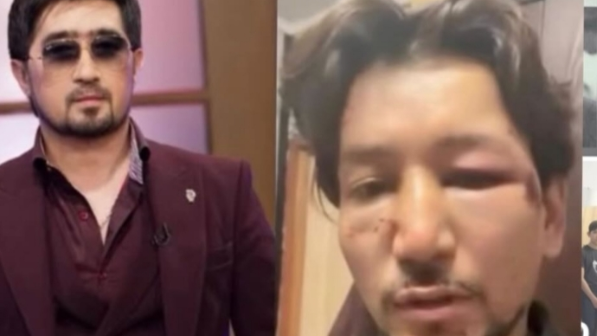 Мұқасан Шахзадаевтан таяқ жеген жігіт жұрт білмейтін шындықты жайып салды