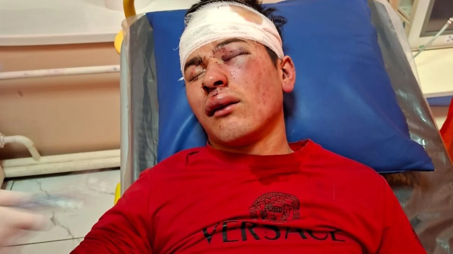 Түркістан облысында сұмдық жағдай: Жігіттің басын езгілеп, дап-даласын шығарған