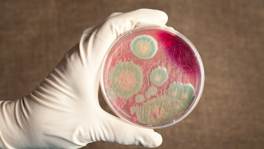 Шымкентте аса қауіпті инфекция туралы дерек тіркелді