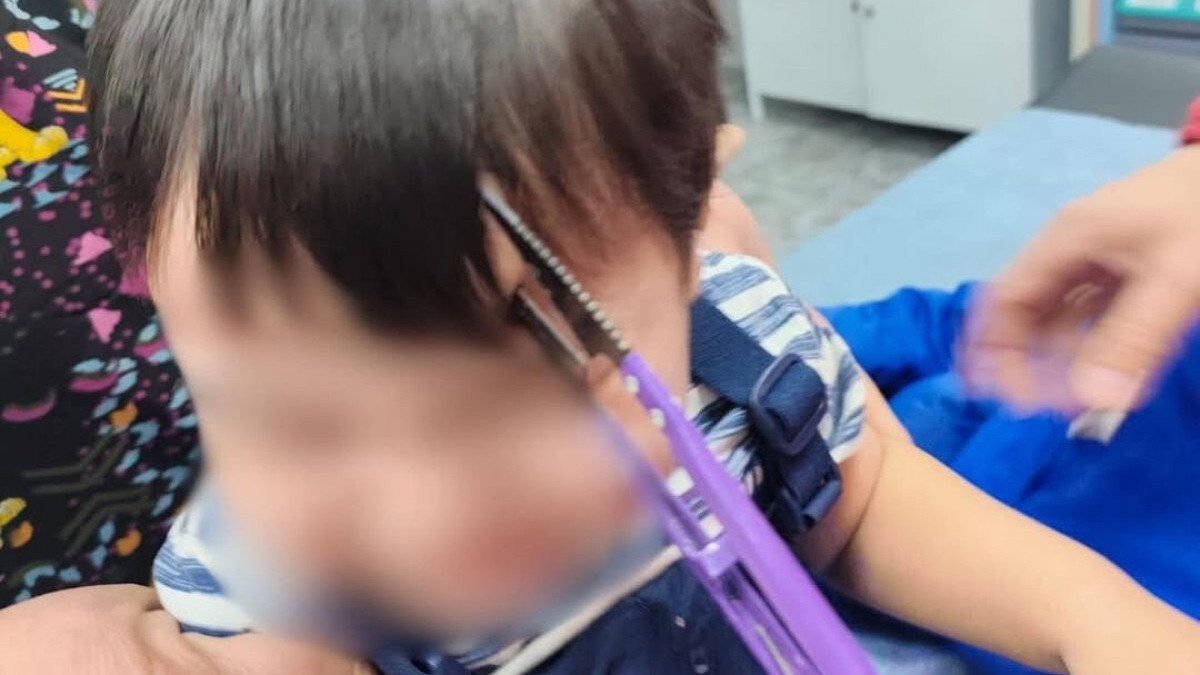 Алматылық баланың маңдайына қайшы қадалған